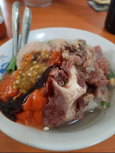 BASO TULANG RUSUK